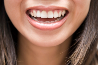 up close of womans teeth